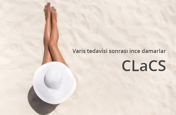 CLaCS İstanbul: İnce Damarlar İçin Çözüm