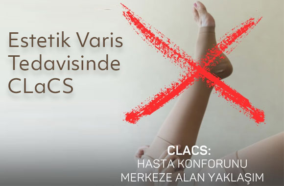 Estetik Varis Tedavisinde CLaCS Yöntemi