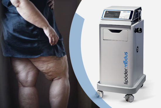 ESWT (Şok Dalga Tedavisi)